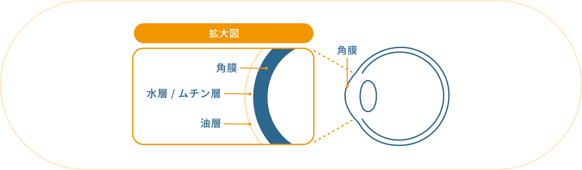 ドライアイの原因