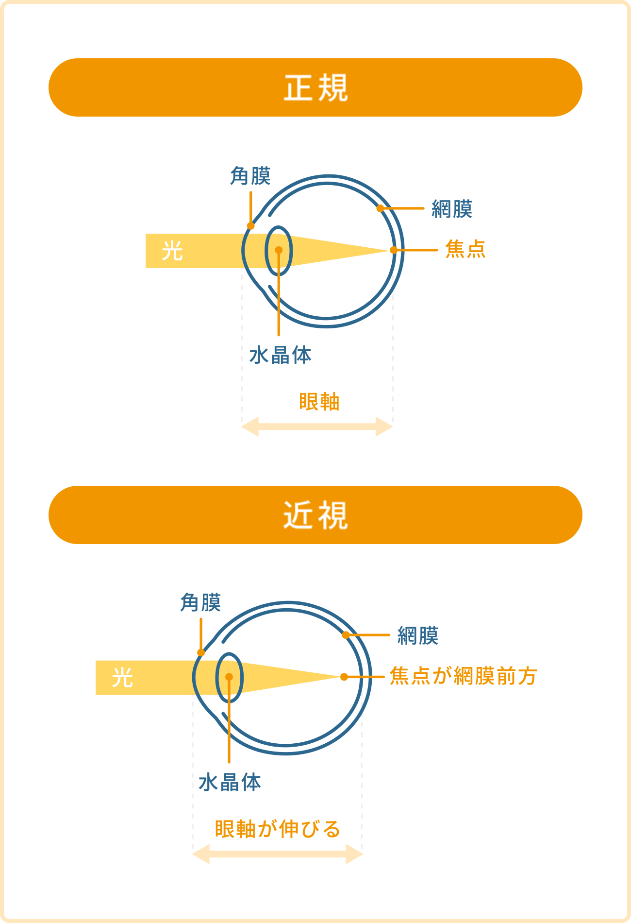 近視の仕組み